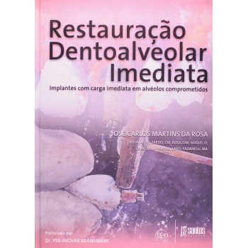 Restauração Dentoalveolar Imediata - Implantes com Carga Imediata em Alvéolos Comprometidos