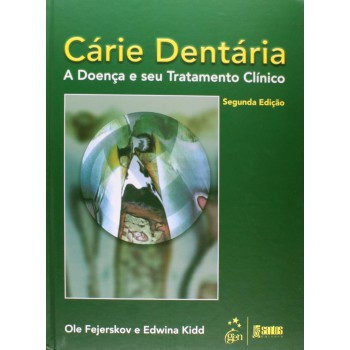 Cárie Dentária