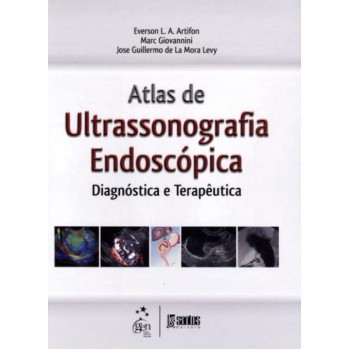 Atlas de Ultrassonografia Endoscópica Diagnóstica e Terapêutica