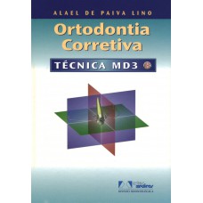 Ortodontia Corretiva: Técnica Md3