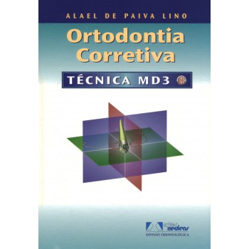 Ortodontia Corretiva: Técnica Md3