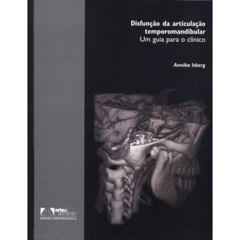 Disfunção Da Articulação Temporomandibular