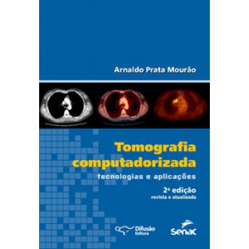 Tomografia Computadorizada: Tecnologias E Aplicações