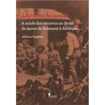 Lágrimas De Sangue: A Saúde Dos Escravos No Brasil Da época De Palmares à Abolição