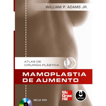 Mamoplastia De Aumento: Atlas De Cirurgia Plástica