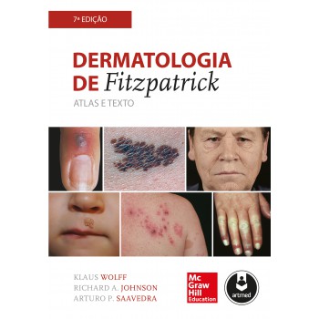 Dermatologia De Fitzpatrick