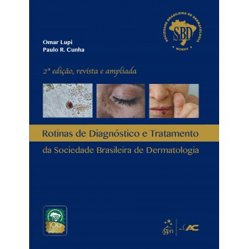 Rotinas De Diagnóstico E Tratamento Da Sociedade Brasileira De Dermatologia - Sbd