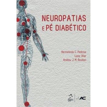 Neuropatias E Pé Diabético