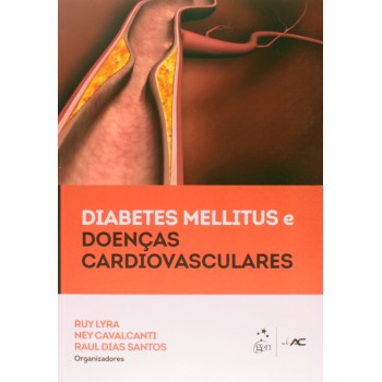 Diabetes Mellitus E Doenças Cardiovasculares
