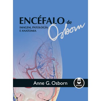 Encéfalo De Osborn: Imagem, Patologia E Anatomia