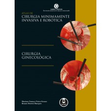 Atlas De Cirurgia Minimamente Invasiva E Robótica: Cirurgia Ginecológica