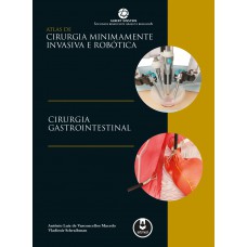 Atlas De Cirurgia Minimamente Invasiva E Robótica: Cirurgia Gastrointestinal