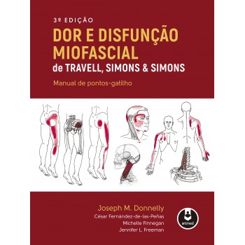 Dor E Disfunção Miofascial De Travell, Simons & Simons: Manual De Pontos-gatilho