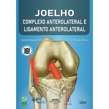 Joelho : Complexo Anterolateral E Ligamento Anterolateral