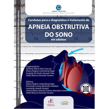 Condutas Para O Diagnóstico E Tratamento De Apneia Obstrutiva Do Sono Em Adultos