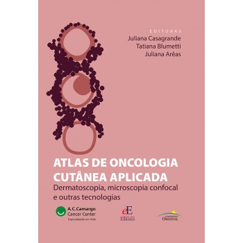 Atlas De Oncologia Cutânea Aplicada: Dermatoscopia, Microscopia Confocal E Outras Tecnologias