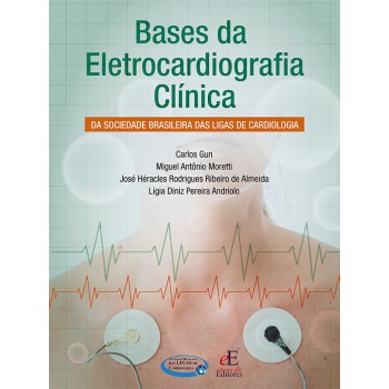 Bases Da Eletrocardiografia Clínica: Da Sociedade Brasileira Das Ligas De Cardiologia