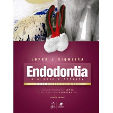 Endodontia - Biologia E Técnica