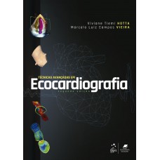 Técnicas Avançadas Em Ecocardiografia