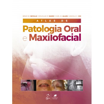 Atlas De Patologia Oral E Maxilofacial