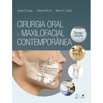 Cirurgia Oral E Maxilofacial Contemporânea