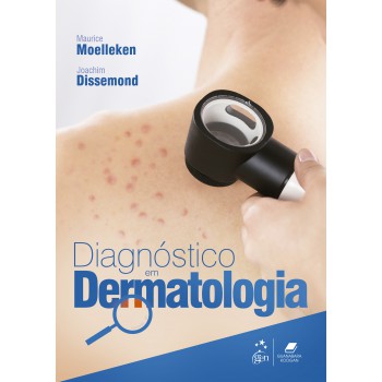 Diagnóstico Em Dermatologia